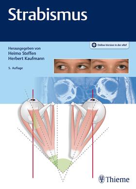 Kaufmann / Steffen |  Strabismus | eBook | Sack Fachmedien