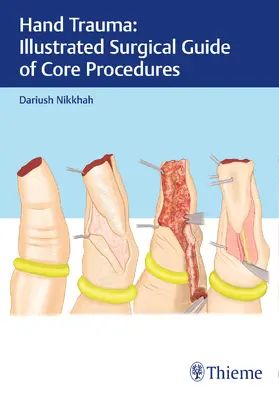 Nikkhah |  Hand Trauma: Illustrated Surgical Guide of Core Procedures | Buch |  Sack Fachmedien