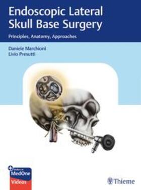 Marchioni / Presutti |  Endoscopic Lateral Skull Base Surgery | eBook | Sack Fachmedien