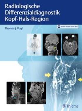 Vogl |  Radiologische Differenzialdiagnostik Kopf-Hals-Region | Buch |  Sack Fachmedien