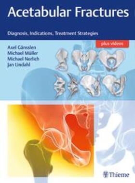 Gänsslen / Müller / Nerlich |  Acetabular Fractures | Buch |  Sack Fachmedien