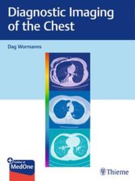 Wormanns |  Diagnostic Imaging of the Chest | eBook | Sack Fachmedien