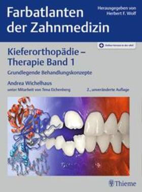 Wichelhaus |  Farbatlanten der Zahnmedizin 9: Kieferorthopädie - Therapie. Band 1 | Buch |  Sack Fachmedien