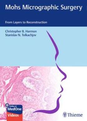 Harmon / Tolkachjov | Mohs Micrographic Surgery: From Layers to Reconstruction | Medienkombination | 978-3-13-242017-5 | sack.de