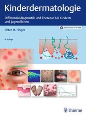 Höger |  Kinderdermatologie | Buch |  Sack Fachmedien