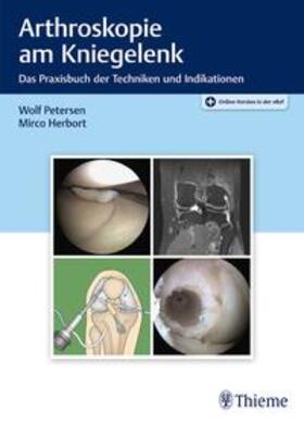 Petersen / Herbort | Arthroskopie am Kniegelenk | Medienkombination | 978-3-13-242225-4 | sack.de