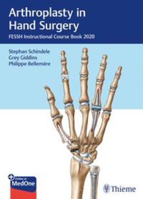 Schindele / Giddins / Bellemère |  Arthroplasty in Hand Surgery | Buch |  Sack Fachmedien