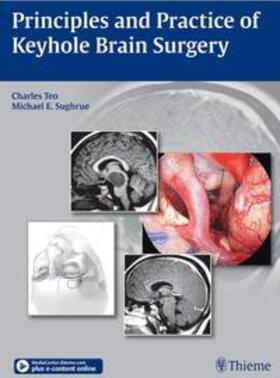 Teo / Sughrue |  Principles and Practice of Keyhole Brain Surgery | Buch |  Sack Fachmedien