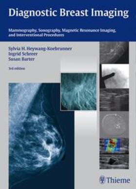 Heywang-Köbrunner / Schreer / Barter |  Diagnostic Breast Imaging | Buch |  Sack Fachmedien