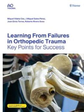 Videla Cés / Rivero Sosa / Sales Pérez |  Learning From Failures in Orthopedic Trauma | Buch |  Sack Fachmedien