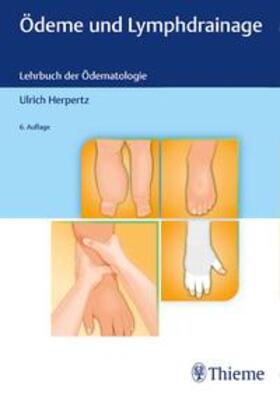 Herpertz | Ödeme und Lymphdrainage | Buch | 978-3-13-243580-3 | sack.de