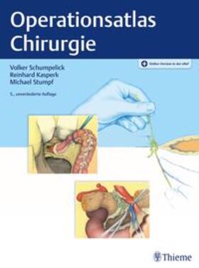 Schumpelick / Kasperk / Stumpf |  Operationsatlas Chirurgie | Buch |  Sack Fachmedien