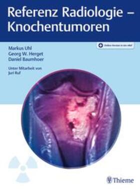 Uhl / Herget / Baumhoer |  Referenz Radiologie - Knochentumoren | eBook | Sack Fachmedien