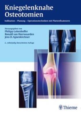 Lobenhoffer / van Heerwaarden / Agneskirchner |  Kniegelenknahe Osteotomien | Buch |  Sack Fachmedien