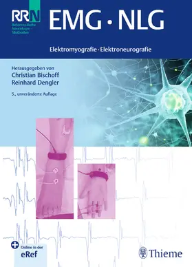 Bischoff / Dengler |  EMG NLG | Buch |  Sack Fachmedien