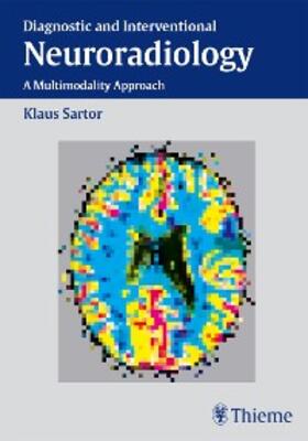 Sartor |  Diagnostic and Interventional Neuroradiology | eBook | Sack Fachmedien