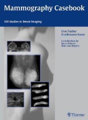 Fischer |  Mammography Casebook | eBook | Sack Fachmedien