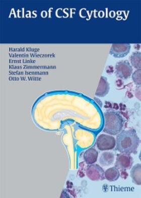 Kluge / Wieczorek / Linke |  Atlas of CSF Cytology | eBook | Sack Fachmedien