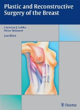 Gabka / Bohmert |  Plastic and Reconstructive Surgery of the Breast | eBook | Sack Fachmedien