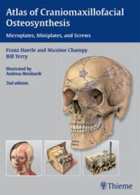 Härle / Champy / Terry |  Atlas of Craniomaxillofacial Osteosynthesis | eBook | Sack Fachmedien