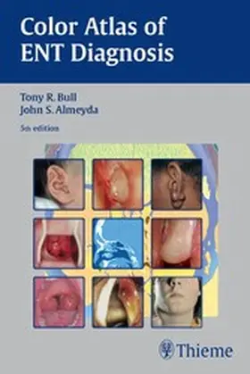 Bull / Almeyda |  Color Atlas of ENT Diagnosis | eBook | Sack Fachmedien