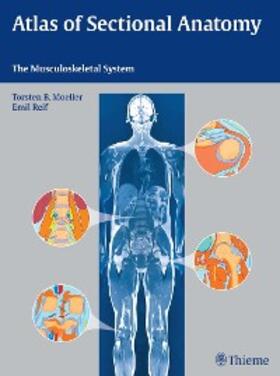 Möller / Reif |  Atlas of Sectional Anatomy | eBook | Sack Fachmedien