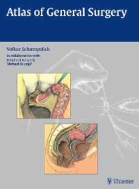 Schumpelick |  Atlas of General  Surgery | eBook | Sack Fachmedien