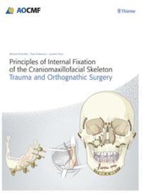 Prein / Ehrenfeld / Manson |  Principles of Internal Fixation of the Craniomaxillofacial Skeleton | eBook | Sack Fachmedien