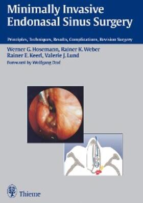 Hosemann / Lund / Weber |  Minimally Invasive Endonasal Sinus Surgery | eBook | Sack Fachmedien