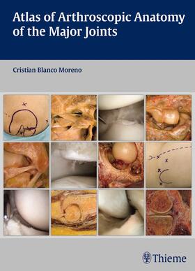 Blanco Moreno |  Atlas of Arthroscopic Anatomy of the Major Joints | eBook | Sack Fachmedien