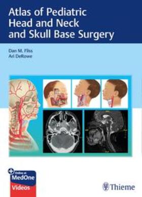 Fliss / DeRowe |  Atlas of Pediatric Head and Neck and Skull Base Surgery | eBook | Sack Fachmedien