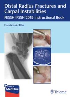 Pinal |  Distal Radius Fractures and Carpal Instabilities | eBook | Sack Fachmedien
