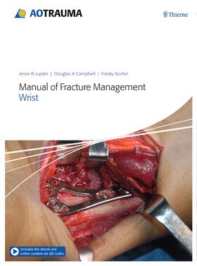 Jupiter / Campbell / Nunez |  Manual of Fracture Management - Wrist | eBook | Sack Fachmedien