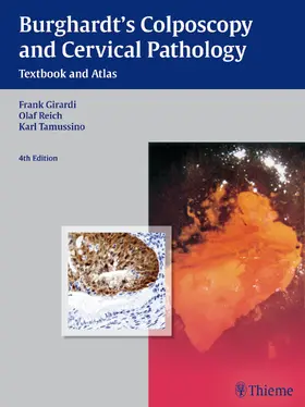 Girardi / Burghardt / Reich |  Burghardt's Colposcopy and Cervical Pathology | Buch |  Sack Fachmedien