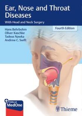Behrbohm / Nawka / Kaschke | Ear, Nose, and Throat Diseases | Buch | 978-3-13-671204-7 | sack.de