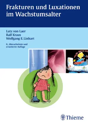  Frakturen und Luxationen im Wachstumsalter | Buch |  Sack Fachmedien