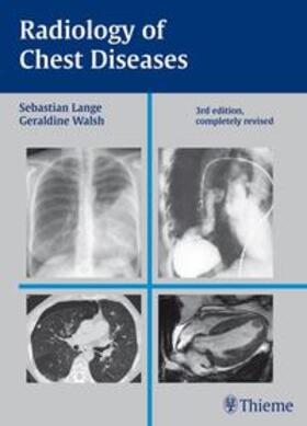 Lange / Walsh |  Radiology of Chest Diseases | Buch |  Sack Fachmedien