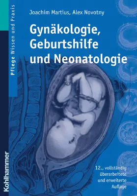 Martius / Novotny |  Gynäkologie, Geburtshilfe und Neonatologie | Buch |  Sack Fachmedien