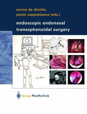 Cappabianca / Divitiis |  Endoscopic Endonasal Transsphenoidal Surgery | Buch |  Sack Fachmedien