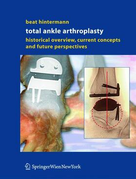 Hintermann |  Total Ankle Arthroplasty | Buch |  Sack Fachmedien