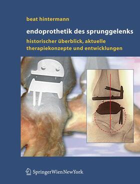 Hintermann |  Endoprothetik des Sprunggelenks | Buch |  Sack Fachmedien