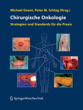 Gnant / Schlag |  Chirurgische Onkologie | eBook | Sack Fachmedien