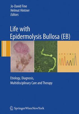 Fine / Hintner |  Life with Epidermolysis Bullosa (EB) | Buch |  Sack Fachmedien