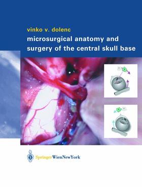 Dolenc |  Microsurgical Anatomy and Surgery of the Central Skull Base | Buch |  Sack Fachmedien