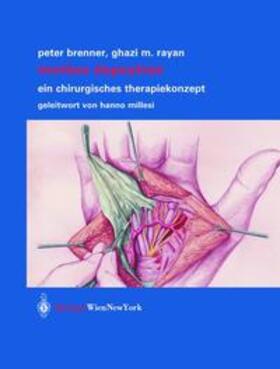 Brenner / Rayan |  Morbus Dupuytren | Buch |  Sack Fachmedien