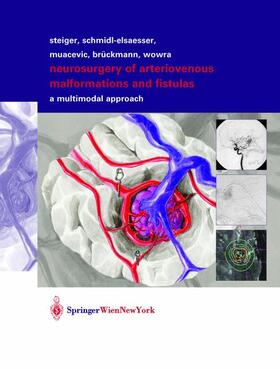 Schmid-Elsaesser / Wowra / Muacevic |  Neurosurgery of Arteriovenous Malformations and Fistulas | Buch |  Sack Fachmedien