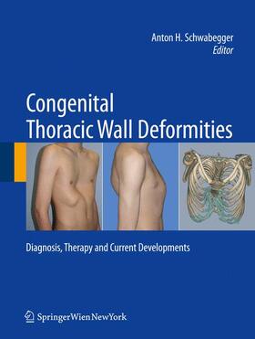 Schwabegger |  Congenital Thoracic Wall Deformities | Buch |  Sack Fachmedien