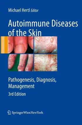 Hertl |  Autoimmune Diseases of the Skin | Buch |  Sack Fachmedien