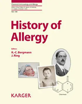 Bergmann / Ring |  History of Allergy | Buch |  Sack Fachmedien