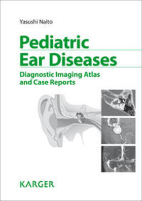 Naito |  Pediatric Ear Diseases | Buch |  Sack Fachmedien
